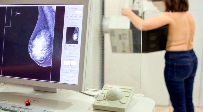 Un nou tractament augmenta la supervivència de pacients amb un tipus de càncer de mama metastàtic